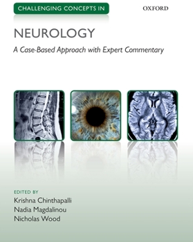 Paperback Challenging Concepts in Neurology: Cases with Expert Commentary Book