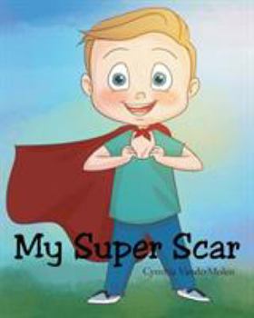 Paperback My Super Scar Book