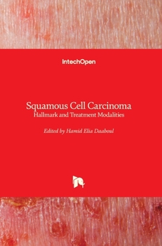 Hardcover Squamous Cell Carcinoma: Hallmark and Treatment Modalities Book