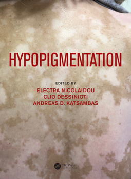 Hardcover Hypopigmentation Book