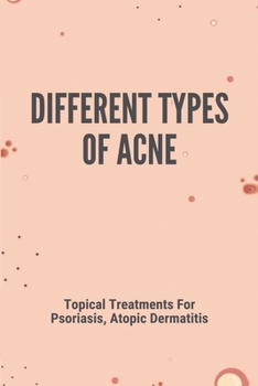 Paperback Different Types Of Acne: Topical Treatments For Psoriasis, Atopic Dermatitis Book
