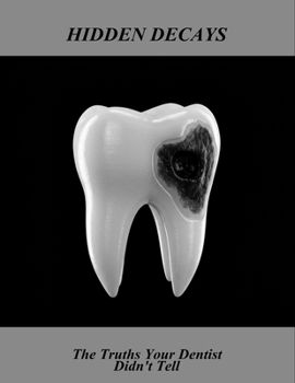 Paperback Hidden Decays: The Truths Your Dentist Didn'T Tell Book