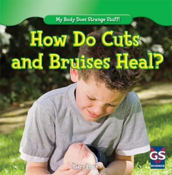 How Do Cuts and Bruises Heal? - Book  of the My Body Does Strange Stuff!