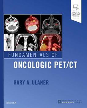 Paperback Fundamentals of Oncologic Pet/CT Book