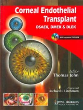 Hardcover Corneal Endothelial Transplant: Dsaek. Dmek and Dlek Book