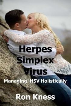 Paperback Herpes Simplex Virus: Managing HSV Holistically Book