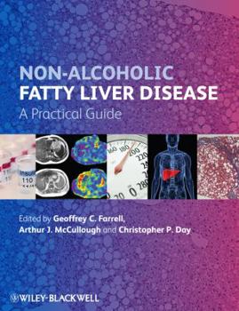 Hardcover Non-Alcoholic Fatty Liver Disease: A Practical Guide Book