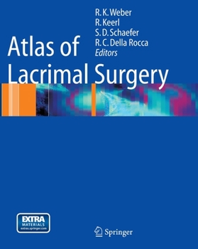 Paperback Atlas of Lacrimal Surgery Book