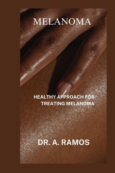 Paperback Melanoma: Healthy Approach for Treating Melanoma Book
