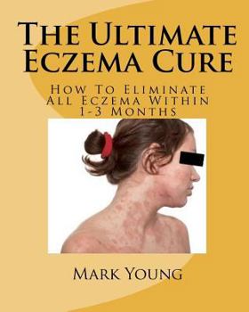 Paperback The Ultimate Eczema Cure Book