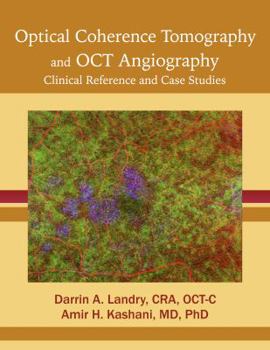 Paperback Optical Coherence Tomography and OCT Angiography: Clinical Reference and Case Studies Book