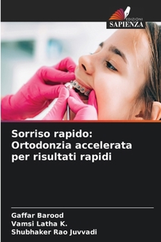 Paperback Sorriso rapido: Ortodonzia accelerata per risultati rapidi [Italian] Book