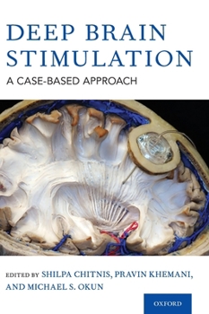 Hardcover Deep Brain Stimulation: A Case-Based Approach Book