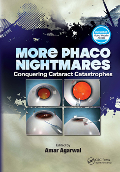 Hardcover More Phaco Nightmares: Conquering Cataract Catastrophes Book