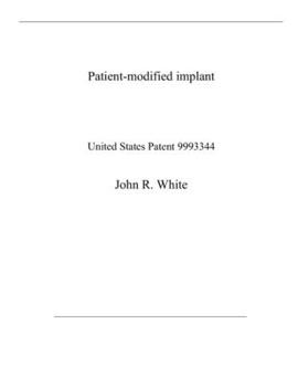 Paperback Patient-modified implant: United States Patent 9993344 Book