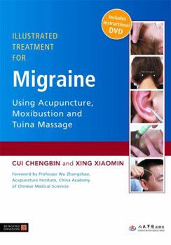 Paperback Illustrated Treatment for Migraine Using Acupuncture, Moxibustion and Tuina Massage [With DVD] Book