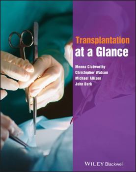 Paperback Transplantation at a Glance Book