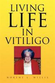 Paperback Living Life in Vitiligo Book