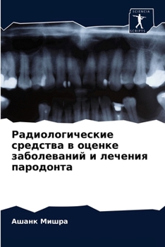 Радиологические средства в оценке заболеваний и лечения пародонта