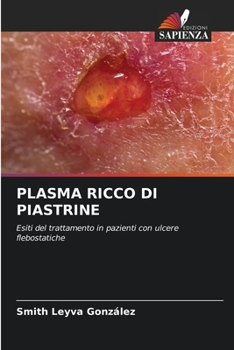 Paperback Plasma Ricco Di Piastrine [Italian] Book