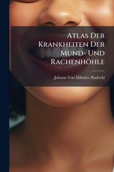Paperback Atlas Der Krankheiten Der Mund- Und Rachenhöhle [German] Book