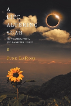 Paperback A Life Altering Scar: How Family, Faith, and Laughter Helped Book