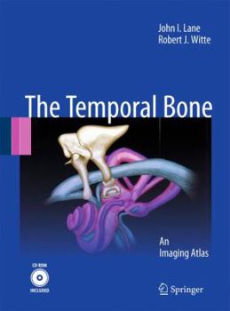 Hardcover The Temporal Bone: An Imaging Atlas [With CDROM] Book