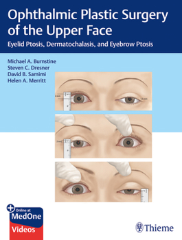 Hardcover Ophthalmic Plastic Surgery of the Upper Face: Eyelid Ptosis, Dermatochalasis, and Eyebrow Ptosis Book