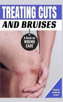 Paperback Treating Cuts and Bruises: A Book on Wound Care Book