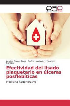 Paperback Efectividad del lisado plaquetario en úlceras posflebíticas [Spanish] Book