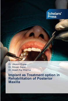 Paperback Implant as Treatment option in Rehabilitation of Posterior Maxilla Book