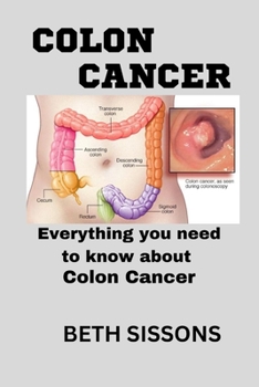 Paperback Colon Cancer: Everything you need to know about colon cancer [Large Print] Book