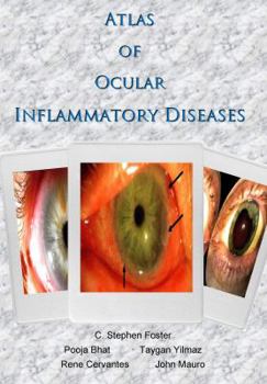 Paperback Atlas of Ocular Inflammatory Diseases Book