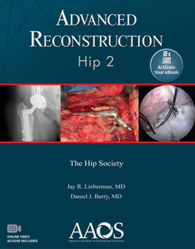 Paperback Advanced Reconstruction: Hip 2: Print + eBook with Multimedia Book