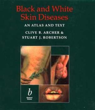 Hardcover Black and White Skin Diseases: An Atlas and Text Book