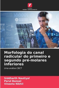 Paperback Morfologia do canal radicular do primeiro e segundo pré-molares inferiores [Portuguese] Book