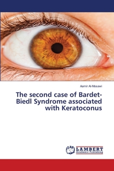 The second case of Bardet-Biedl Syndrome associated with Keratoconus
