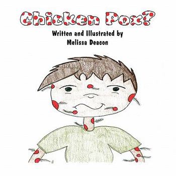 Paperback Chicken Pox? Book