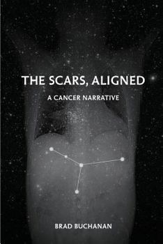 Paperback The Scars, Aligned Book