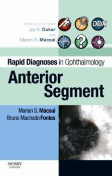 Paperback Rapid Diagnosis in Ophthalmology Series: Anterior Segment (Rapid Diagnoses in Ophthalmology) Book