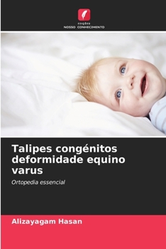 Paperback Talipes congénitos deformidade equino varus [Portuguese] Book