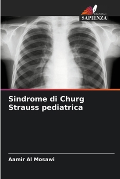 Sindrome di Churg Strauss pediatrica (Italian Edition)