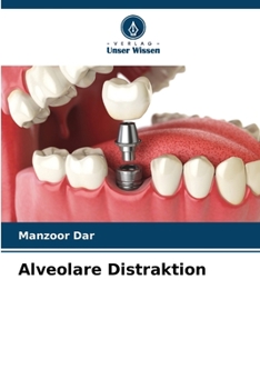 Paperback Alveolare Distraktion [German] Book
