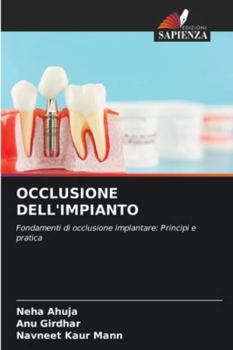 Paperback Occlusione Dell'impianto [Italian] Book