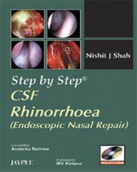Hardcover Step by Step: CSF Rhinorrhoea: Endoscopic Nasal Repair Book
