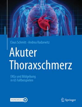 Paperback Akuter Thoraxschmerz: EKGs Und Bildgebung in 65 Fallbeispielen [German] Book