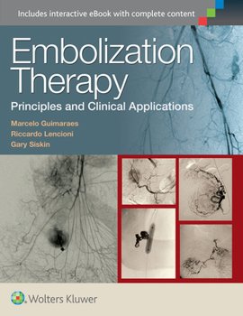 Hardcover Embolization Therapy: Principles and Clinical Applications Book