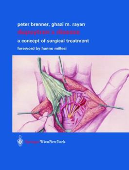 Hardcover Dupuytren's Disease: A Concept of Surgical Treatment Book