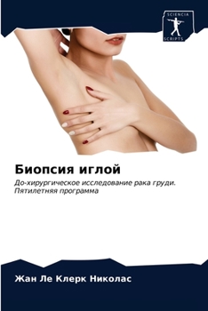 Paperback Биопсия иглой [Russian] Book