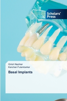 Paperback Basal Implants Book